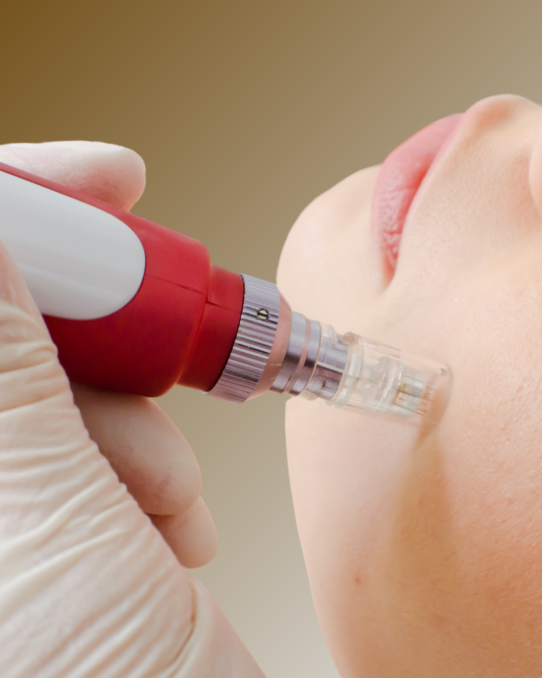 DERMAPEN