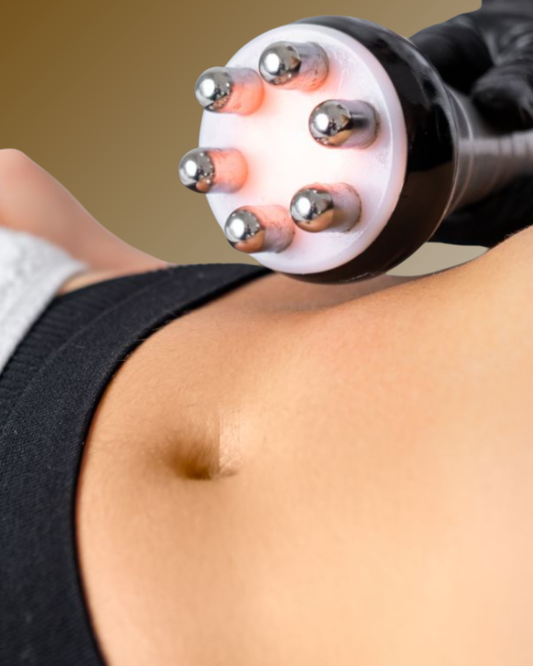 Radiofrecuencia Facial y Corporal