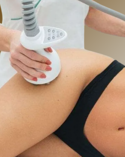 Radiofrecuencia Facial y Corporal