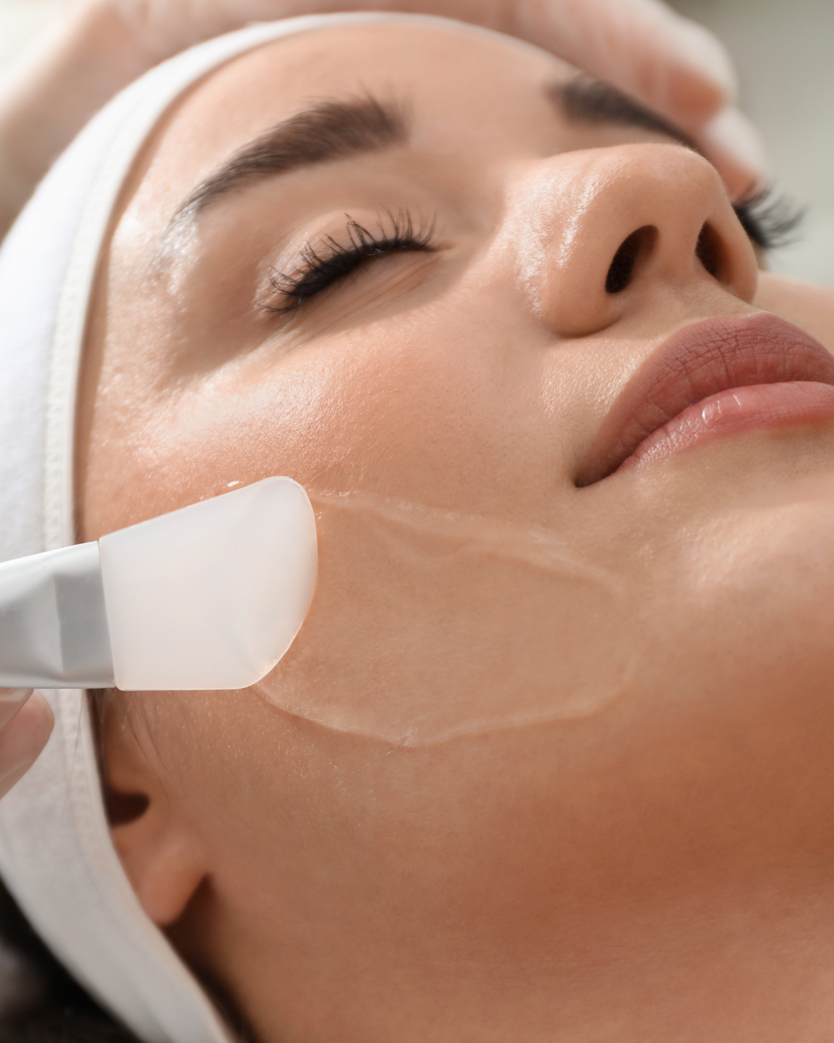 Peeling-quimico-rostro-cuello-cuerpo