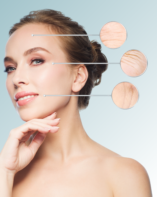 melasma-mejora-la-textura